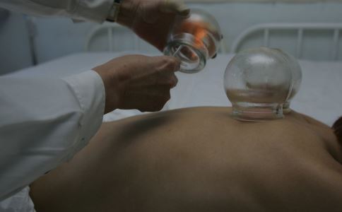 拔罐能养生 但频繁拔罐只会害身体 拔罐有什么好处吗 拔罐选择哪些穴位 可以经常拔罐吗